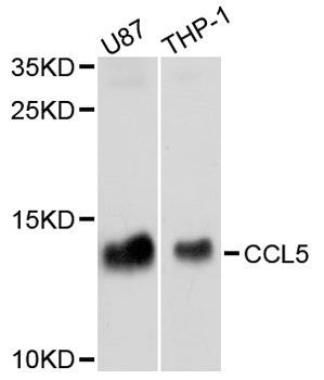 Western blot - CCL5 antibody (144-05630)