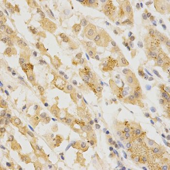 Immunohistochemistry - GGA2 Antibody (144-01186)