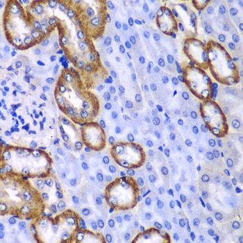 Immunohistochemistry - MYO1C Polyclonal Antibody (144-06936)