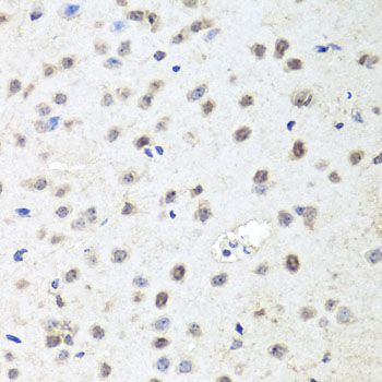 Immunohistochemistry - AGO2 antibody (144-06802)