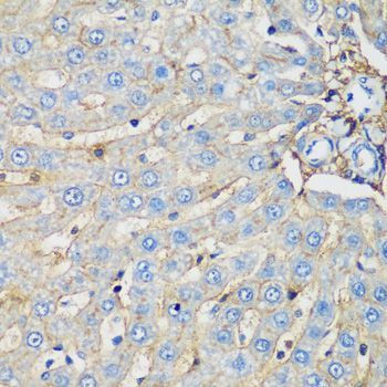 Immunohistochemistry - PROCR antibody (144-60426)