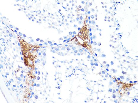 Immunohistochemistry - S100A10 antibody (144-60742)