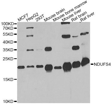 Western blot - NDUFS4 antibody (144-013519)