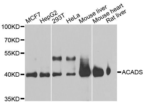 Western blot - ACADS Polyclonal Antibody (144-60044)