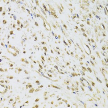 Immunohistochemistry - DDX1 Polyclonal Antibody (144-06575)