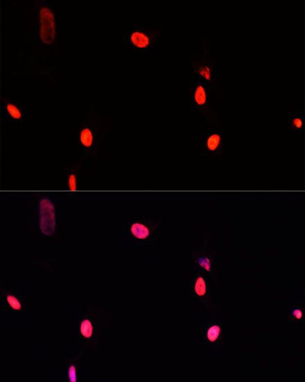Immunofluorescence - GTF2I antibody (144-07898)