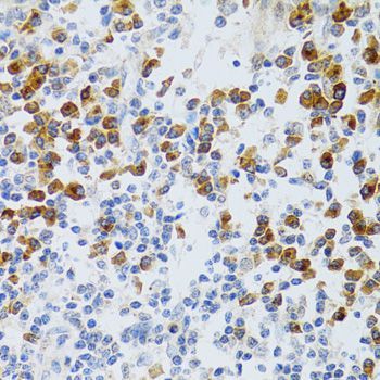 Immunohistochemistry - CHAF1B antibody (144-06259)