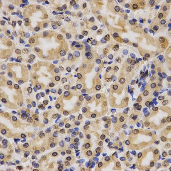 Immunohistochemistry - MonoMethyl-Histone H3-K4 antibody (144-61339)