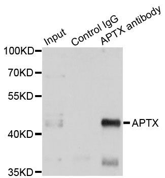 Immunoprecipitation - APTX Polyclonal Antibody (144-05364)