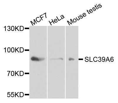 Western blot - SLC39A6 Polyclonal Antibody (144-04584)