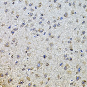 Immunohistochemistry - [KO Validated] EGFR Polyclonal Antibody (144-11351)