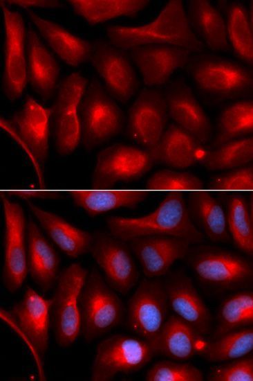 Western blot - PSMA5 Polyclonal Antibody (144-05752)