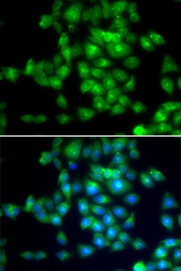 Immunofluorescence - SIRT3 Polyclonal Antibody (144-07307)
