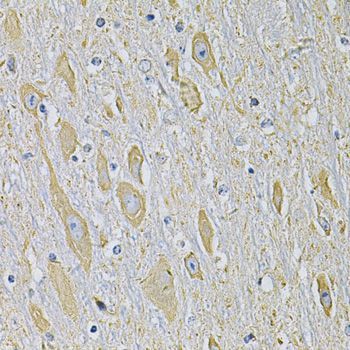 Immunohistochemistry - RAB17 Antibody (144-07831)
