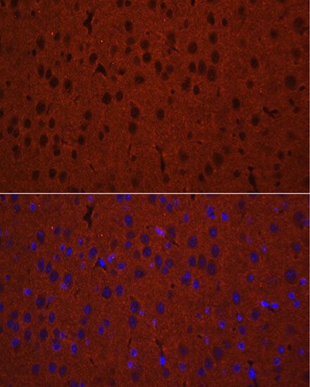 Immunofluorescence - STXBP1 Polyclonal Antibody (144-05420)