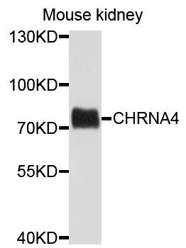Western blot - CHRNA4 antibody (144-01648)