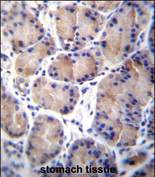 IHC-P