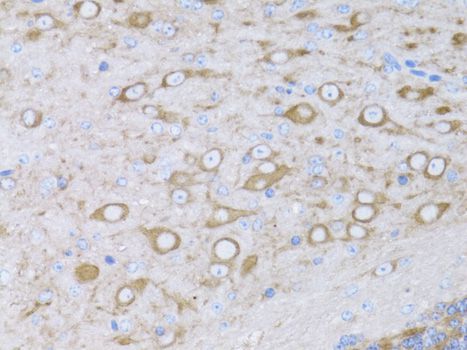 Immunohistochemistry - MYH10 antibody (144-012029)