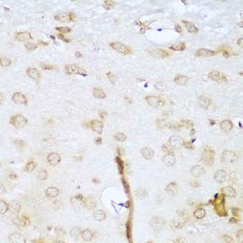 Immunohistochemistry - UBE2L3 Polyclonal Antibody (144-04175)