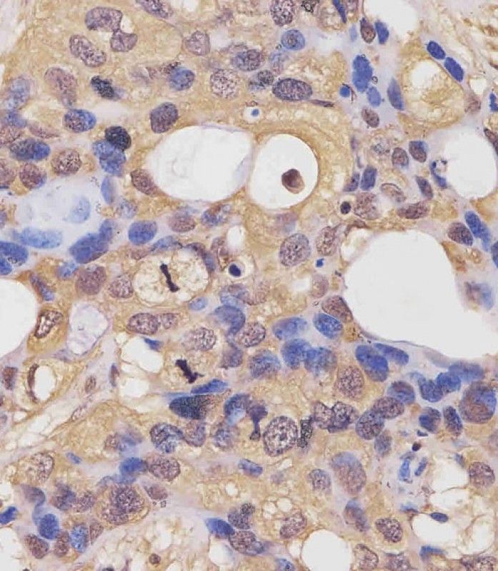 IHC-P
