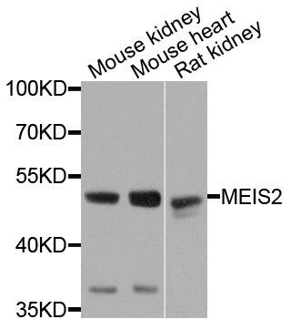 Western blot - MEIS2 Polyclonal Antibody (144-08437)