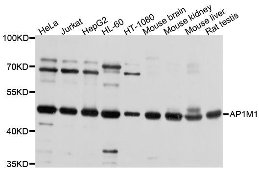 Western blot - AP1M1 Polyclonal Antibody (144-10129)