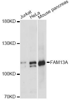 Western blot - FAM13A antibody (144-60714)