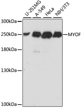Western blot - MYOF antibody (144-61049)