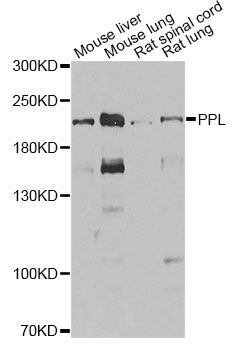 Western blot - PPL Polyclonal Antibody (144-06950)