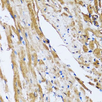 Immunohistochemistry - GOLM1 Polyclonal Antibody (144-07283)