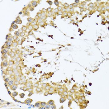 Immunohistochemistry - CCT4 antibody (144-06548)
