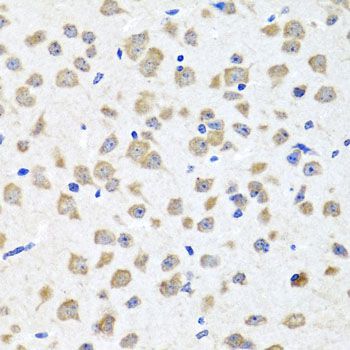 Immunohistochemistry - PIP4K2B antibody (144-08016)