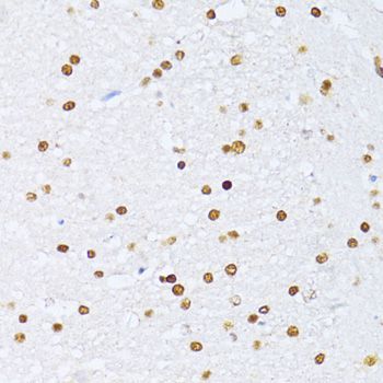 Immunohistochemistry - ZEB2 Polyclonal Antibody (144-05705)