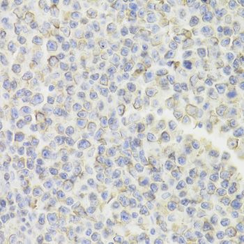 Immunohistochemistry - CD74 Antibody (144-05667)