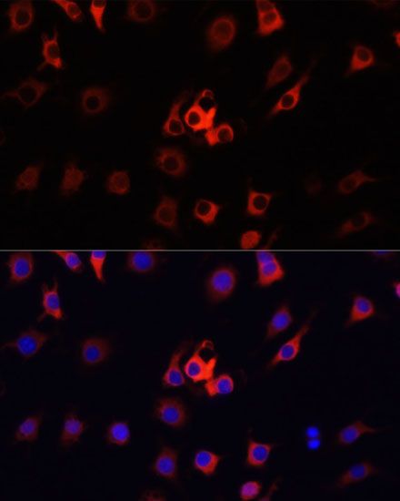 Immunofluorescence - [KO Validated] S100A4 Polyclonal Antibody (144-01631)