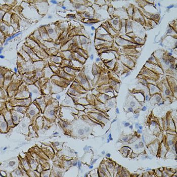 Immunohistochemistry - CLDN3 antibody (144-02946)