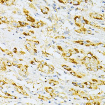Immunohistochemistry - FLT3 antibody (144-012437)