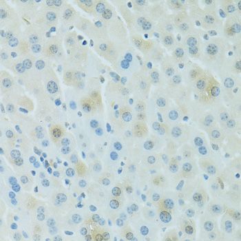 Immunohistochemistry - PDC Polyclonal Antibody (144-60738)