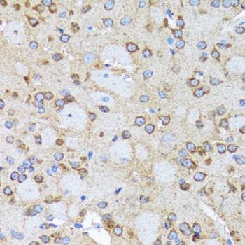 Immunohistochemistry - ACTR2 Polyclonal Antibody (144-05734)