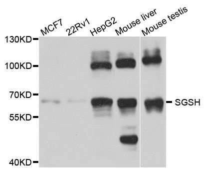 Western blot - SGSH antibody (144-08148)