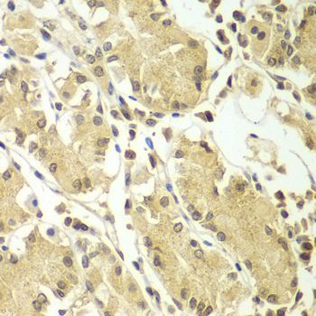 Immunohistochemistry - BCAS3 Polyclonal Antibody (144-07274)