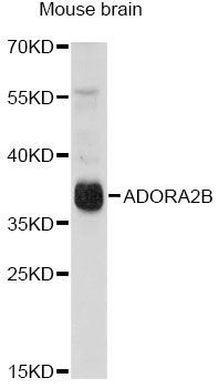 Western blot - ADORA2B antibody (144-61326)