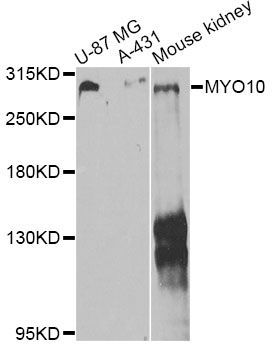 Western blot - MYO10 antibody (144-012471)