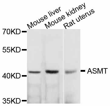 Western blot - ASMT antibody (144-011840)