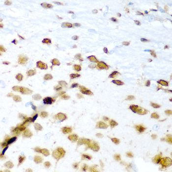 Immunohistochemistry - ELAVL3 antibody (144-06091)