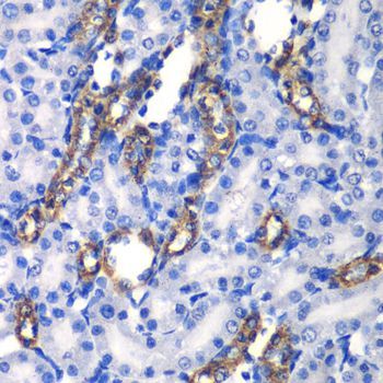 Immunohistochemistry - MATK antibody (144-06651)