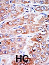 IHC-P