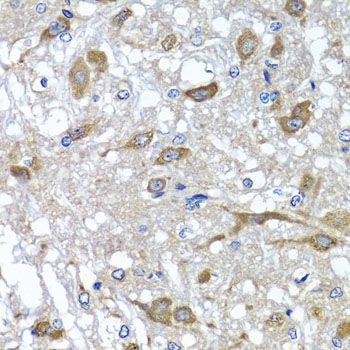 Immunohistochemistry - OSGEPL1 antibody (144-08022)