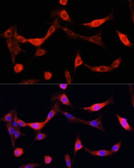 Immunofluorescence - [KO Validated] EGFR Polyclonal Antibody (144-11351)