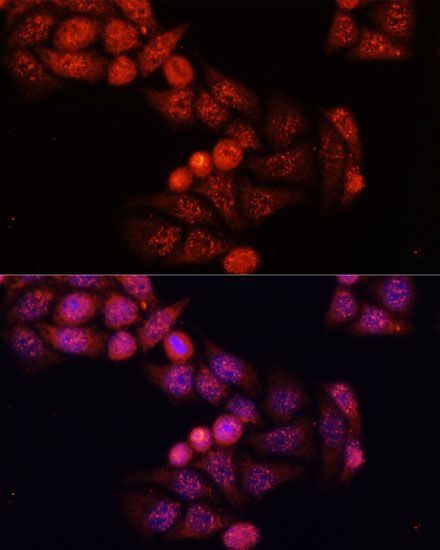 Immunohistochemistry - GSK3B Polyclonal Antibody (144-06164)
